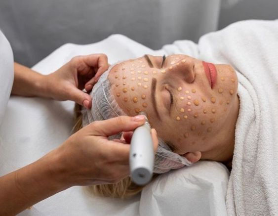 BB Glow Productos Skin Care Puerto Rico y Estados Unidos BioSkin Velet Cosmetics BelleSkin